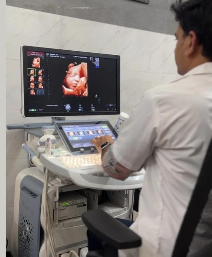 Sonography
