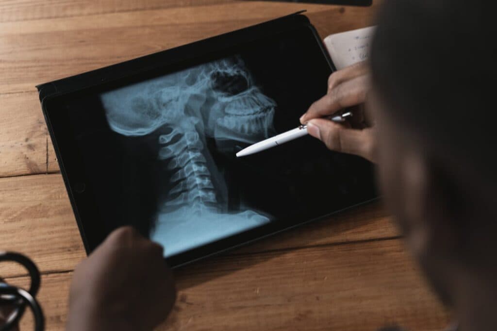 Digital X-Ray